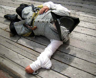 Richard playing dead