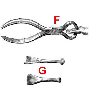 The surgions mate finger amputation and chisels