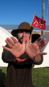 Matty Short Thumb's thumbs