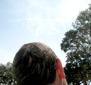 The back of Willie's head